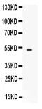 Fc Fragment Of IgG Receptor And Transporter antibody, PB9866, Boster Biological Technology, Western Blot image 