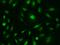 Splicing Factor 3b Subunit 4 antibody, 202889-T02, Sino Biological, Immunohistochemistry frozen image 