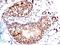Small Ubiquitin Like Modifier 1 antibody, NBP2-45338, Novus Biologicals, Immunohistochemistry paraffin image 