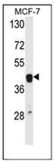 ETS Proto-Oncogene 2, Transcription Factor antibody, AP51471PU-N, Origene, Western Blot image 