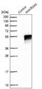 Ankyrin Repeat Domain 40 antibody, NBP1-93516, Novus Biologicals, Western Blot image 