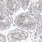 Myocardin Related Transcription Factor A antibody, NBP2-59047, Novus Biologicals, Immunohistochemistry paraffin image 