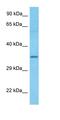 V-Set Domain Containing T Cell Activation Inhibitor 1 antibody, orb331015, Biorbyt, Western Blot image 