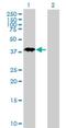 Nanog Homeobox Retrogene P8 antibody, H00388112-B01P, Novus Biologicals, Western Blot image 