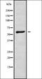 Interleukin 10 Receptor Subunit Beta antibody, orb337753, Biorbyt, Western Blot image 