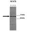 Nuclear Factor Of Activated T Cells 5 antibody, NBP1-80257, Novus Biologicals, Western Blot image 