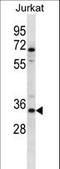 Olfactory Receptor Family 2 Subfamily G Member 3 antibody, LS-C158463, Lifespan Biosciences, Western Blot image 