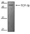 Chaperonin Containing TCP1 Subunit 2 antibody, GTX14137, GeneTex, Western Blot image 