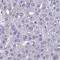 DDB1 And CUL4 Associated Factor 12 Like 2 antibody, HPA044737, Atlas Antibodies, Immunohistochemistry paraffin image 