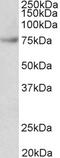 Cholinergic Receptor Muscarinic 2 antibody, 43-080, ProSci, Enzyme Linked Immunosorbent Assay image 