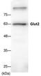 Solute Carrier Family 2 Member 2 antibody, NBP2-22218, Novus Biologicals, Western Blot image 