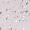 EMAP Like 4 antibody, NBP2-38319, Novus Biologicals, Immunohistochemistry paraffin image 