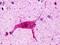 Histamine Receptor H3 antibody, LS-A476, Lifespan Biosciences, Immunohistochemistry paraffin image 
