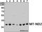 Mitochondrially Encoded NADH:Ubiquinone Oxidoreductase Core Subunit 2 antibody, A04475, Boster Biological Technology, Western Blot image 