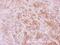 Calpain 11 antibody, PA5-30432, Invitrogen Antibodies, Immunohistochemistry paraffin image 