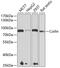Coilin antibody, GTX55575, GeneTex, Western Blot image 
