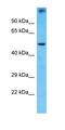 PRAME Family Member 1 antibody, orb327084, Biorbyt, Western Blot image 