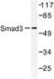 SMAD Family Member 3 antibody, LS-C176302, Lifespan Biosciences, Western Blot image 