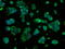 ATP Synthase F1 Subunit Beta antibody, GTX84848, GeneTex, Immunofluorescence image 