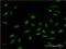 Zinc Finger Protein 256 antibody, H00010172-M01, Novus Biologicals, Immunocytochemistry image 