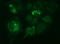 Methylmalonyl-CoA Mutase antibody, LS-C788338, Lifespan Biosciences, Immunofluorescence image 