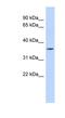 Matrix Metallopeptidase 23B antibody, NBP1-60036, Novus Biologicals, Western Blot image 