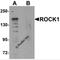 Rho Associated Coiled-Coil Containing Protein Kinase 1 antibody, 6295, ProSci Inc, Western Blot image 