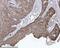 Catenin Delta 1 antibody, M02333-2, Boster Biological Technology, Immunohistochemistry paraffin image 