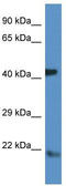 ADP Ribosylation Factor 4 antibody, TA335123, Origene, Western Blot image 
