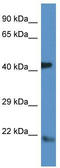 Arf2 antibody, TA335123, Origene, Western Blot image 