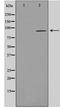 Aryl Hydrocarbon Receptor antibody, LS-C417505, Lifespan Biosciences, Western Blot image 