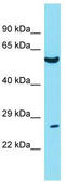 Twist Family BHLH Transcription Factor 1 antibody, TA334163, Origene, Western Blot image 