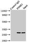 Proteasome Activator Subunit 1 antibody, LS-C676324, Lifespan Biosciences, Immunoprecipitation image 