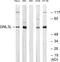 G Protein Nucleolar 3 Like antibody, GTX87842, GeneTex, Western Blot image 