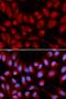 Insulin Degrading Enzyme antibody, orb135709, Biorbyt, Immunofluorescence image 