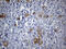LADA antibody, M07940, Boster Biological Technology, Immunohistochemistry paraffin image 