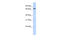 Non-SMC Condensin II Complex Subunit H2 antibody, 27-035, ProSci, Western Blot image 