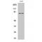 Tyrosinase antibody, LS-C386566, Lifespan Biosciences, Western Blot image 