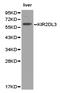 Killer Cell Immunoglobulin Like Receptor, Two Ig Domains And Long Cytoplasmic Tail 3 antibody, LS-C192812, Lifespan Biosciences, Western Blot image 