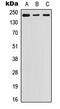 Laminin Subunit Beta 1 antibody, LS-C356152, Lifespan Biosciences, Western Blot image 