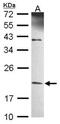 TATA-Box Binding Protein Like 1 antibody, NBP1-31133, Novus Biologicals, Western Blot image 