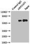 ADP Ribosylation Factor GTPase Activating Protein 3 antibody, LS-C380005, Lifespan Biosciences, Immunoprecipitation image 