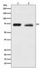 Neurofibromin 2 antibody, M00279, Boster Biological Technology, Western Blot image 