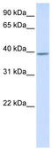 Kelch Domain Containing 2 antibody, TA334512, Origene, Western Blot image 