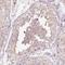 Proline Rich Coiled-Coil 2A antibody, NBP2-33471, Novus Biologicals, Immunohistochemistry paraffin image 
