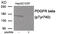 Platelet Derived Growth Factor Receptor Beta antibody, 79-991, ProSci, Western Blot image 