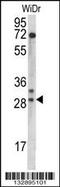 Mitochondrial Ribosomal Protein L9 antibody, 56-813, ProSci, Western Blot image 