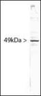Splicing Factor 3b Subunit 4 antibody, orb181493, Biorbyt, Western Blot image 