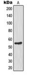 Glucokinase antibody, orb213973, Biorbyt, Western Blot image 