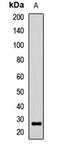 Noggin antibody, LS-C668705, Lifespan Biosciences, Western Blot image 